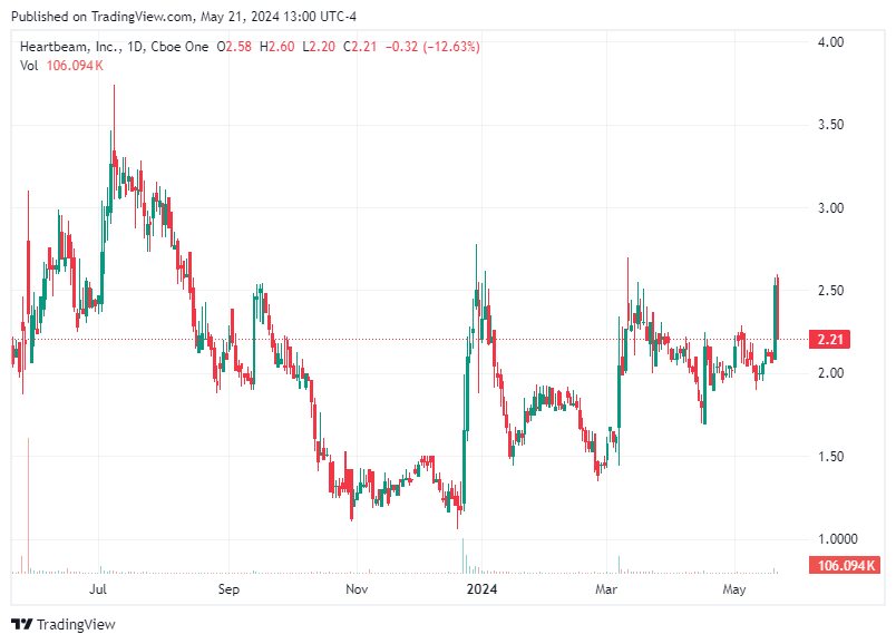 TradingView chart