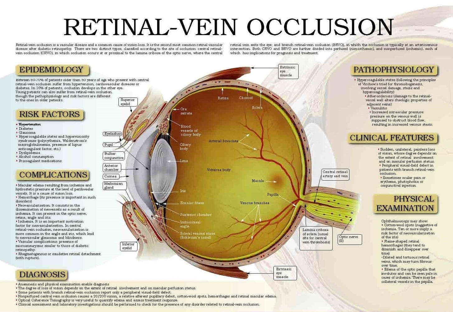 https://healthimpactnews.com/wp-content/uploads/sites/2/2023/05/retinal-vein-occlusion-2-1536x1059.jpg