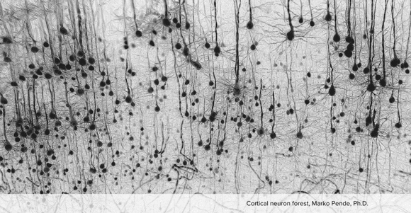 microscopy image of neurons
