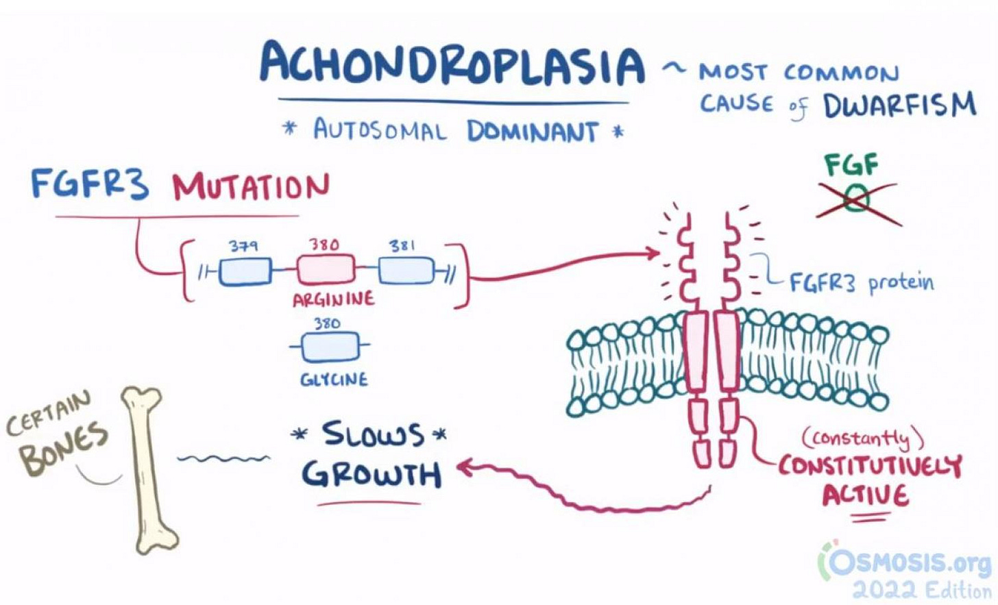 Rare Disease Education: Achondroplasia | Sustainable ...