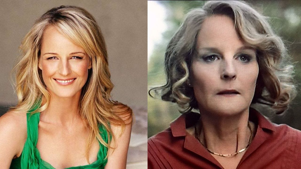 Helen Hunt's Plastic Surgery: What Happened to The I See You Star's Face?  Did The World