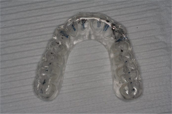 Dental Update - Occlusal splints: the role and fabrication of stabilization  splints