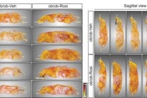 Figure 1 Adipose tissue remodeling after acute rosiglitazone treatment