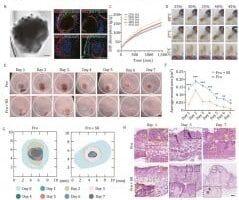 Gelatin-hydrogel wrapped skin organoids promote wound healing in frostbite-affected skin.