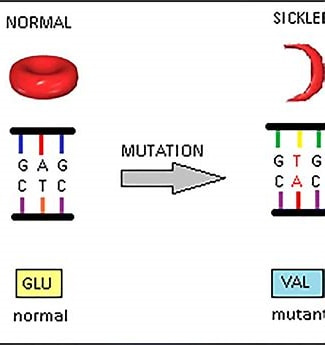 Image result for Genetic Mutation In Sickle Cell Disease. Size: 174 x 185. Source: amirramzan8.blogspot.com