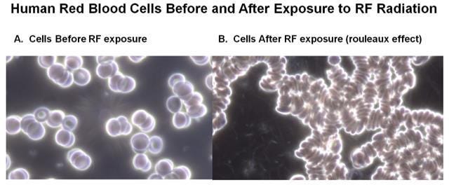 A comparison of cells before and after exposure

AI-generated content may be incorrect.