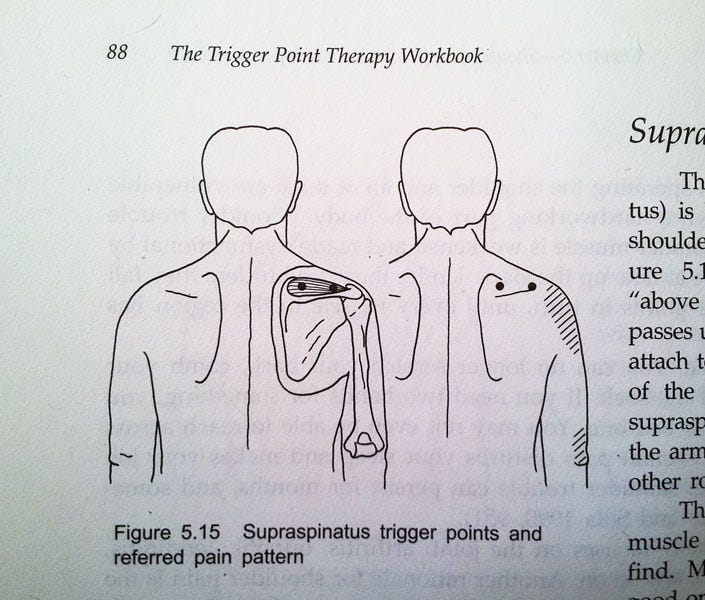 Trigger Point Therapy Workbook review - HathaYoga.com