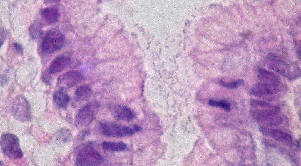 A slide showing a pink-purple stained section of stomach tissue with cells visible, with a gap at center filled with tiny curved oval bacteria. A slide showing a pink-purple stained section of stomach tissue with cells visible, with a gap at center filled with tiny curved oval bacteria.