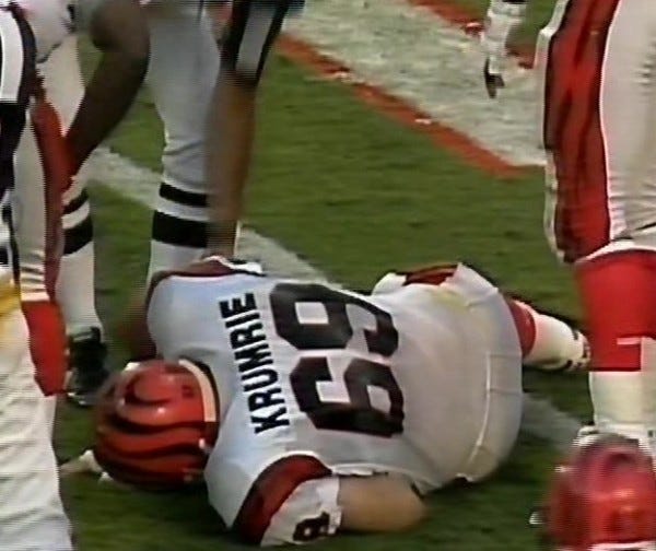 tim krumrie leg worst football injury ever 2015