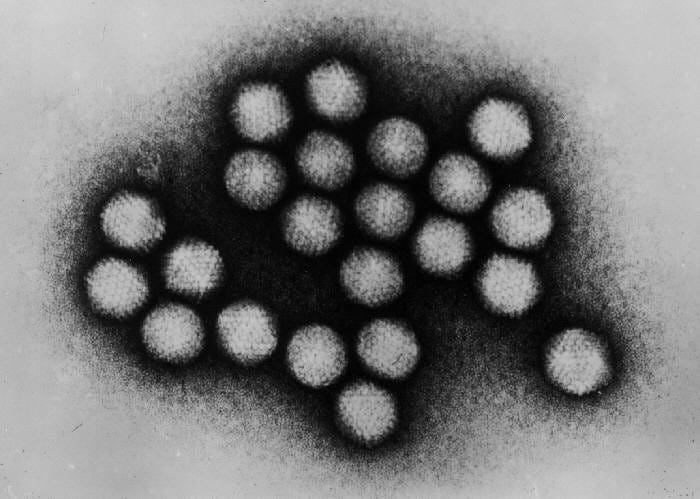 File:Adenovirus transmission electron micrograph B82-0142 lores.jpg