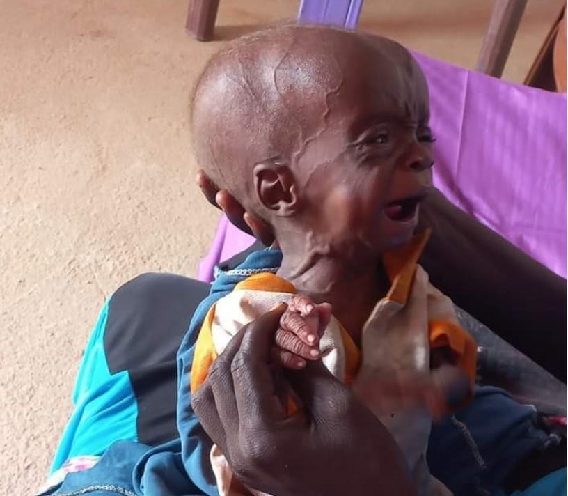 Our “Rwanda Moment”—Famine Threatens Millions in Darfur – Martin Plaut