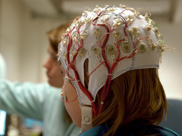 EEG (Electroencephalogram): Purpose, Procedure, and Risks