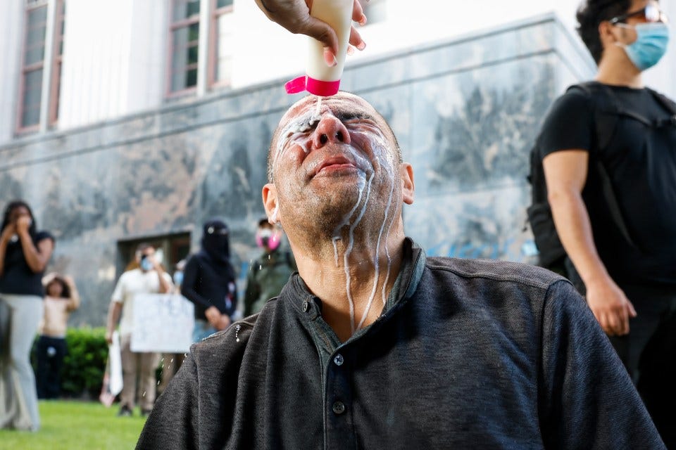 Protester having his eyes rinsed after tear gas exposure at a protest.
