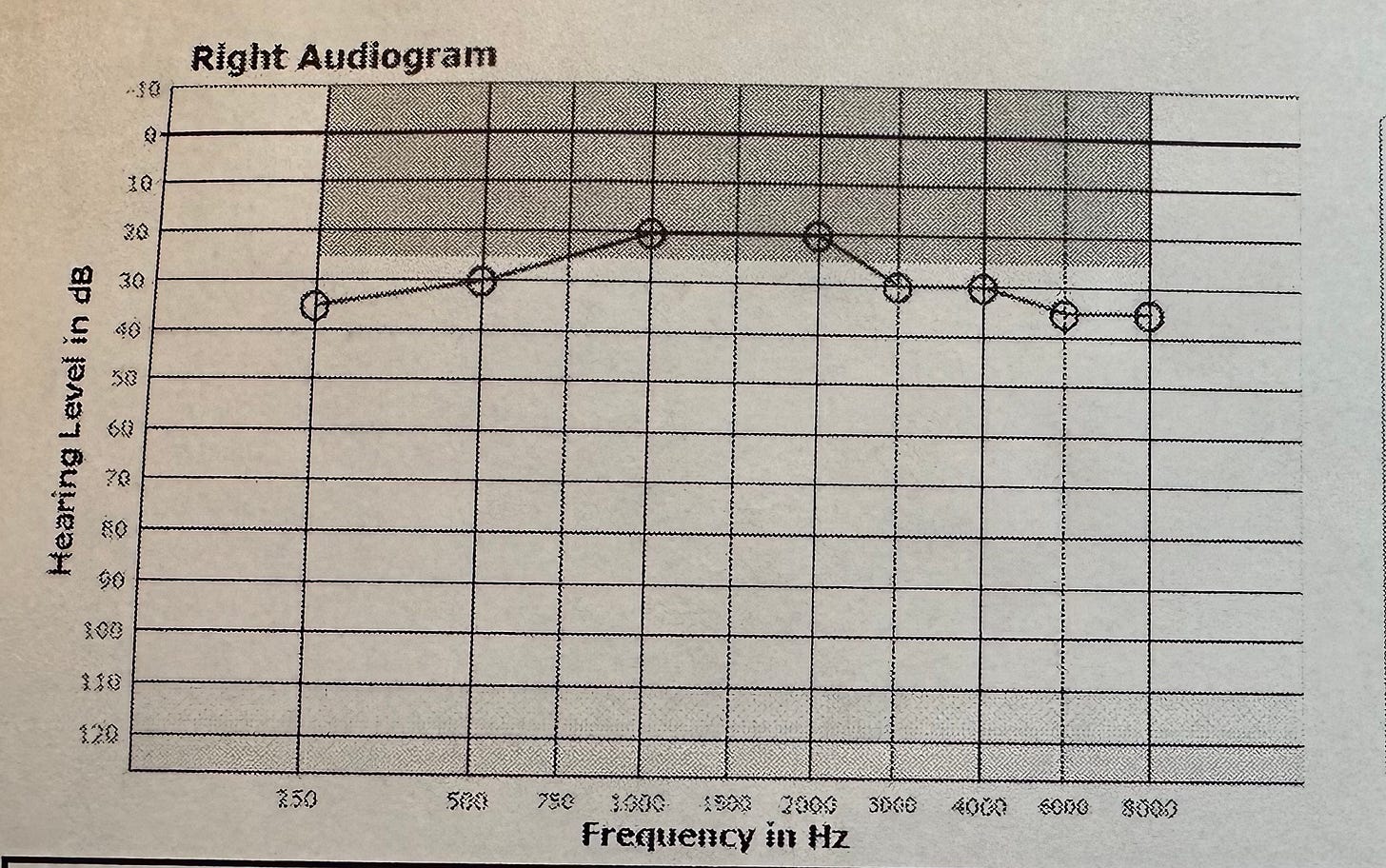 right ear audiogram results