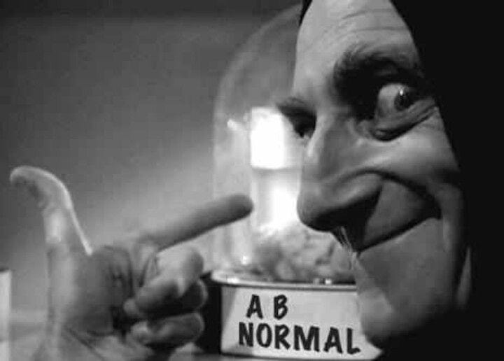 Marty Feldman as Igor in Young Frankenstien, pointing at "Abby Normal's" brain