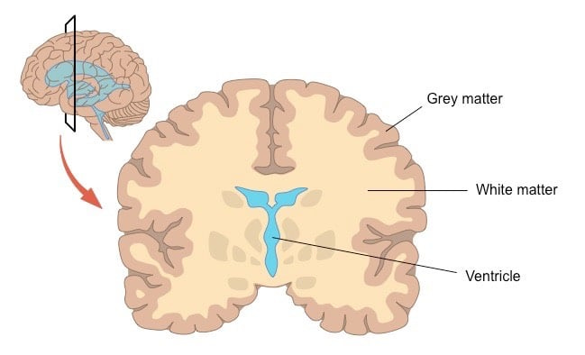 What Is White Matter In The Brain