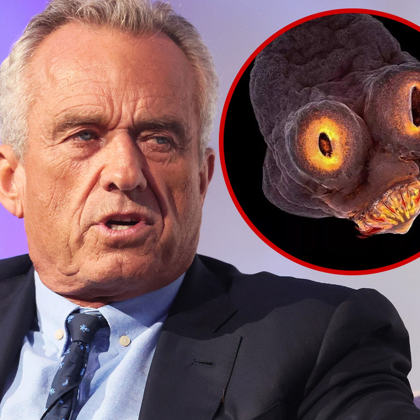 Robert F. Kennedy Jr. Says a Worm Ate Part of His Brain Years Ago