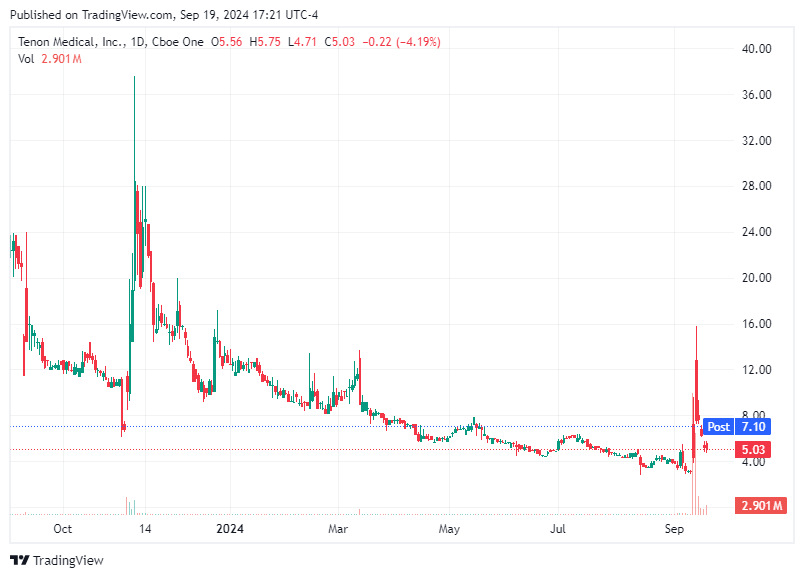 TradingView chart