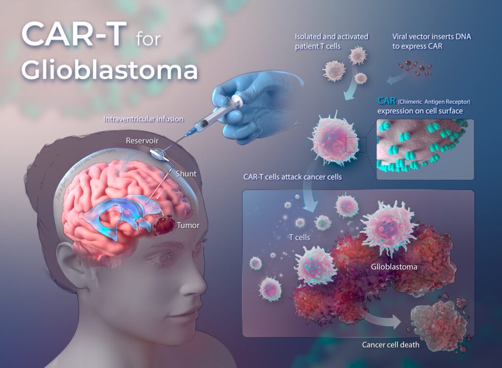 Phase I Clinical Trial Using CAR-T for Glioblastoma to Begin at UNC Medical  Center | Newsroom
