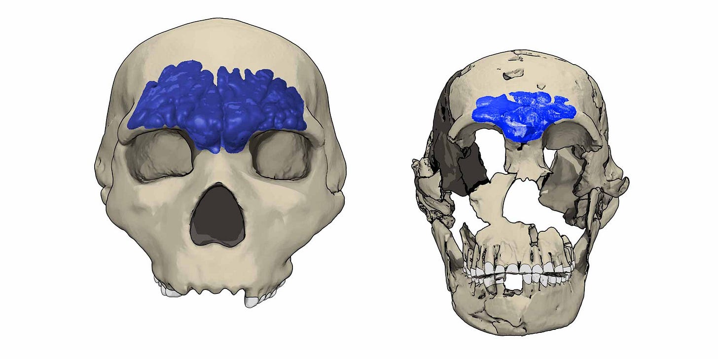 Crania of Petralona and LES1 showing the extent of their frontal sinuses