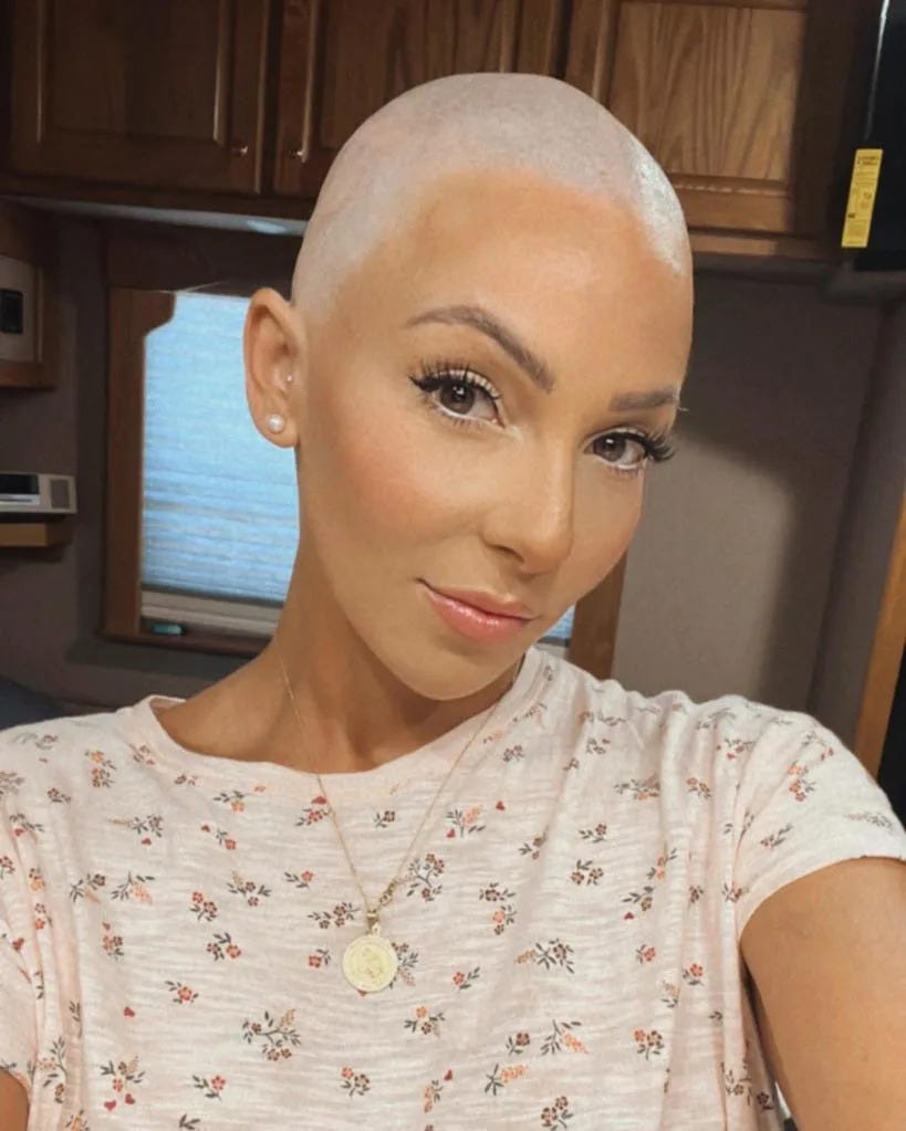 Lizzy Musi shared selfies after shaving her head during her cancer battle. Lizzy Musi/Instagram