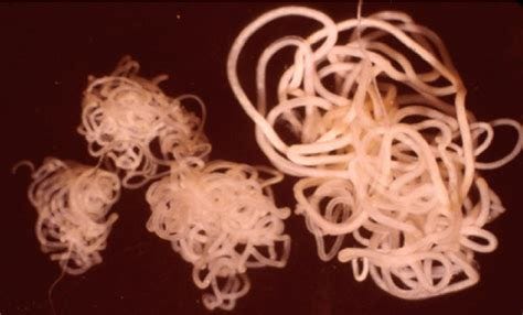 Onchocerca volvulus filarial parasites (three adult males and one adult... | Download Scientific ...