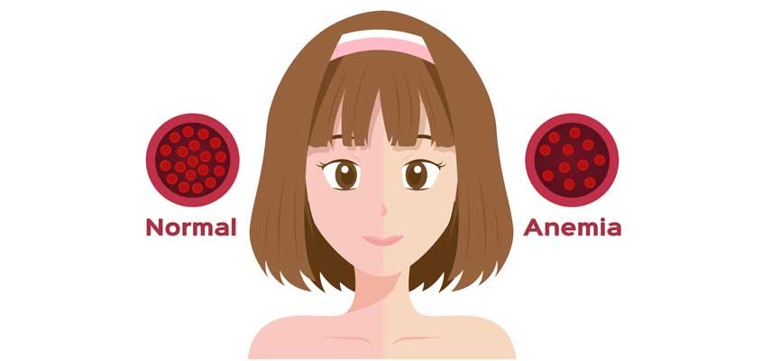 Why Anemia in Women Is More Common - Magnolia Regional Health Center