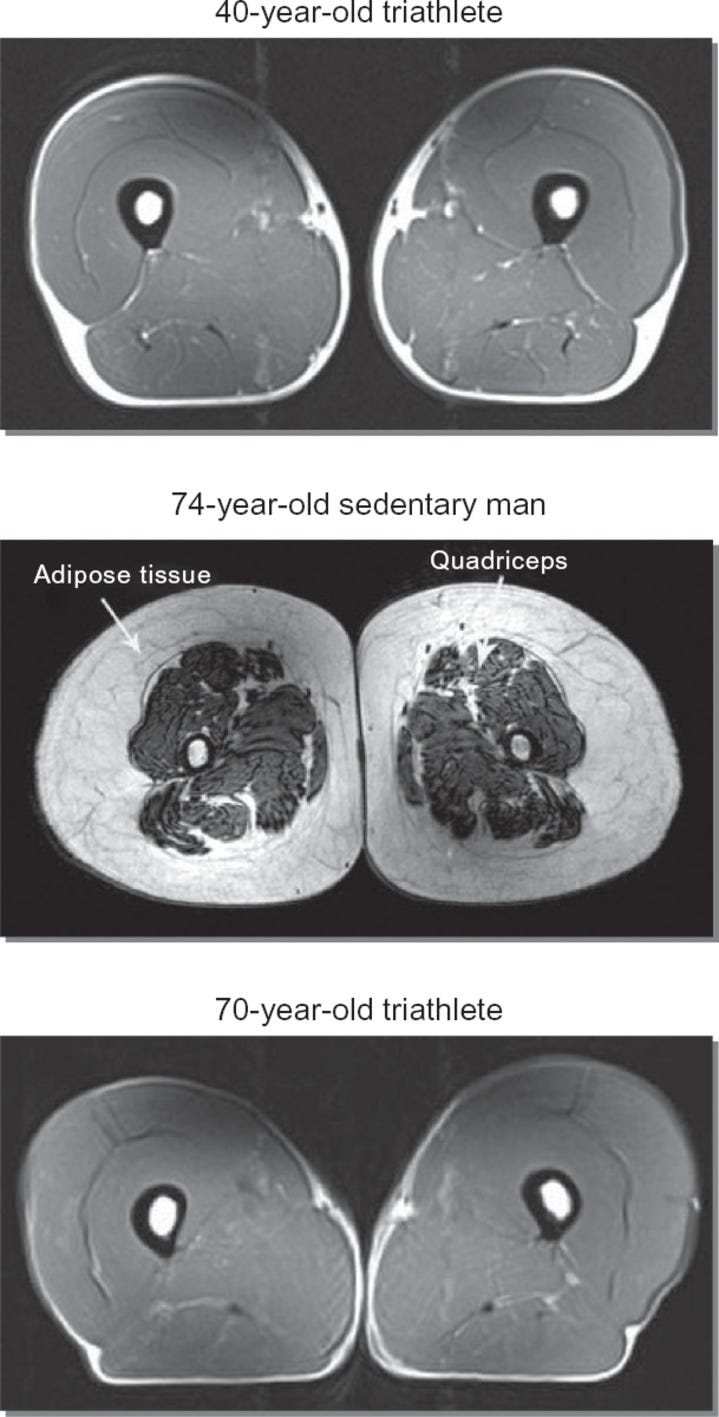 Use it or Lose it: A Graphic Illustration — BETTER MOVEMENT