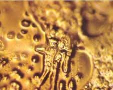 Water Crystal- You make me sick (Emoto Masaru)