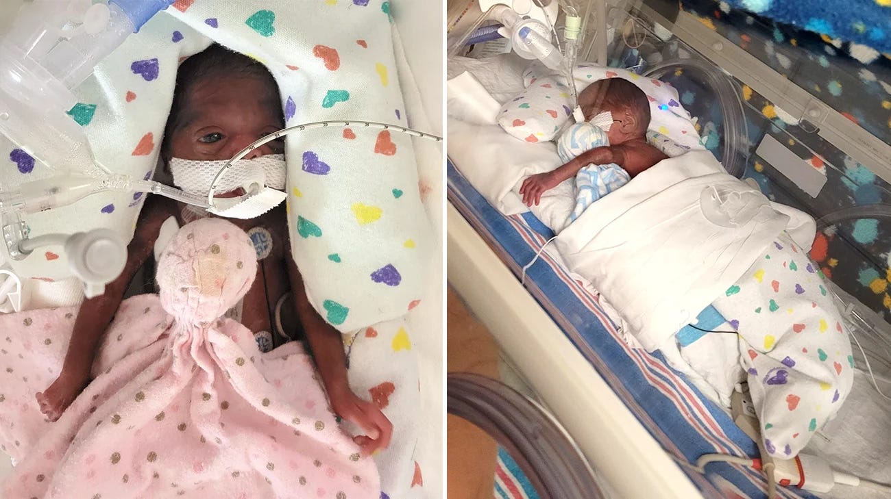 After Kimyah and DJ were born, they were promptly taken to the neonatal intensive care unit where they spent more than four months. (Courtesy: Kimberly Thomas)