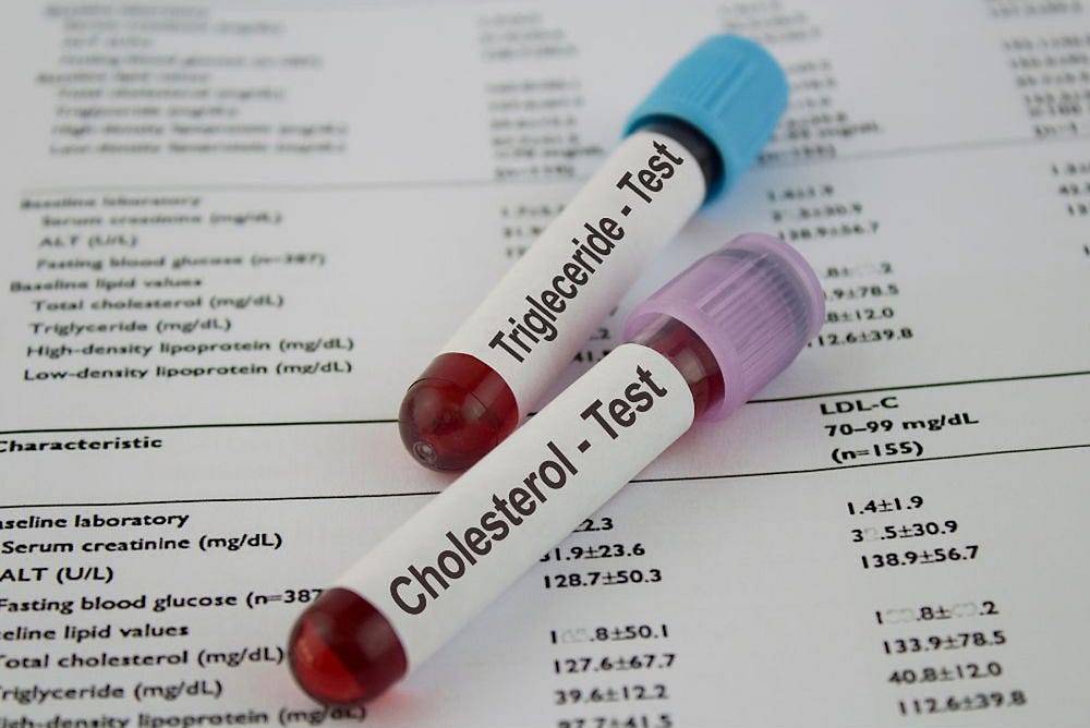 cholesterol test