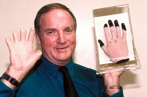 Bronco Lane pictured in 2000: he donated the fingertips and toes he lost to frostbite to the National Army Museum, where they are preserved in formaldehyde