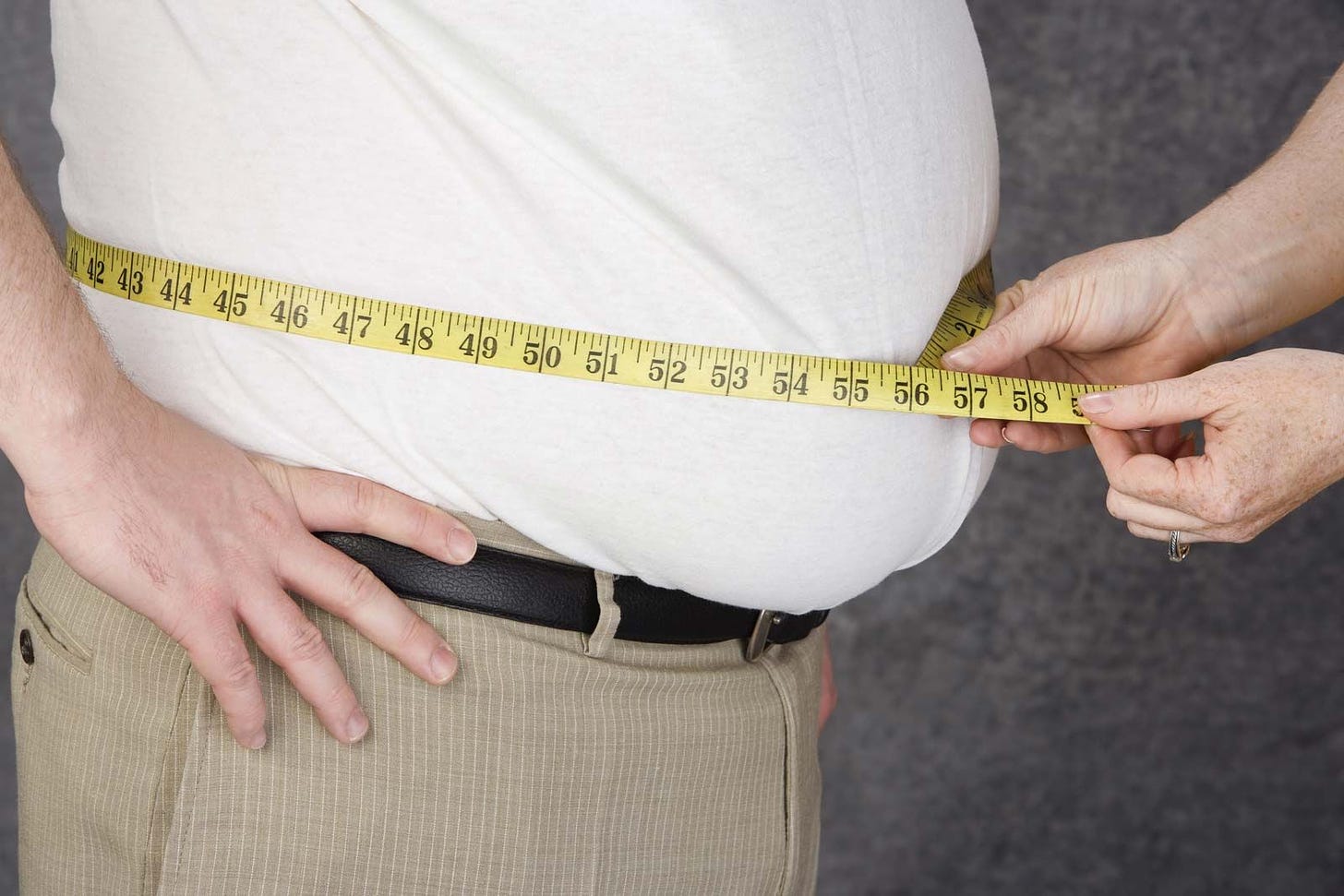 <b>Obesity</b> | Definition, Causes, Health Effects, &amp; Facts | Britannica