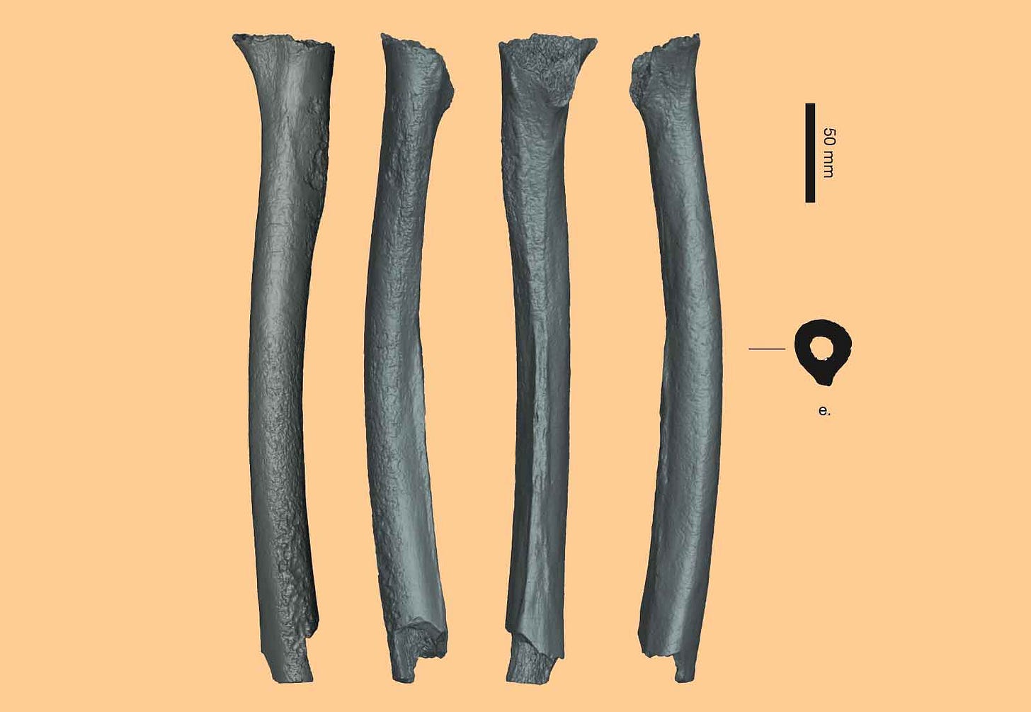 Four views of a CT rendering of a partial femur, with cross-section and scale