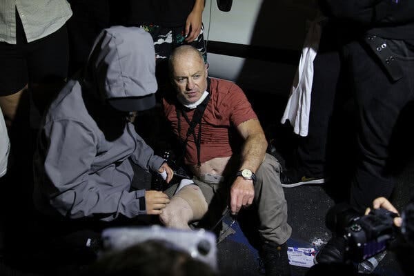 A man wearing a maroon T-shirt and a camera strap around his neck sitting after being struck in the right leg with a projectile. 