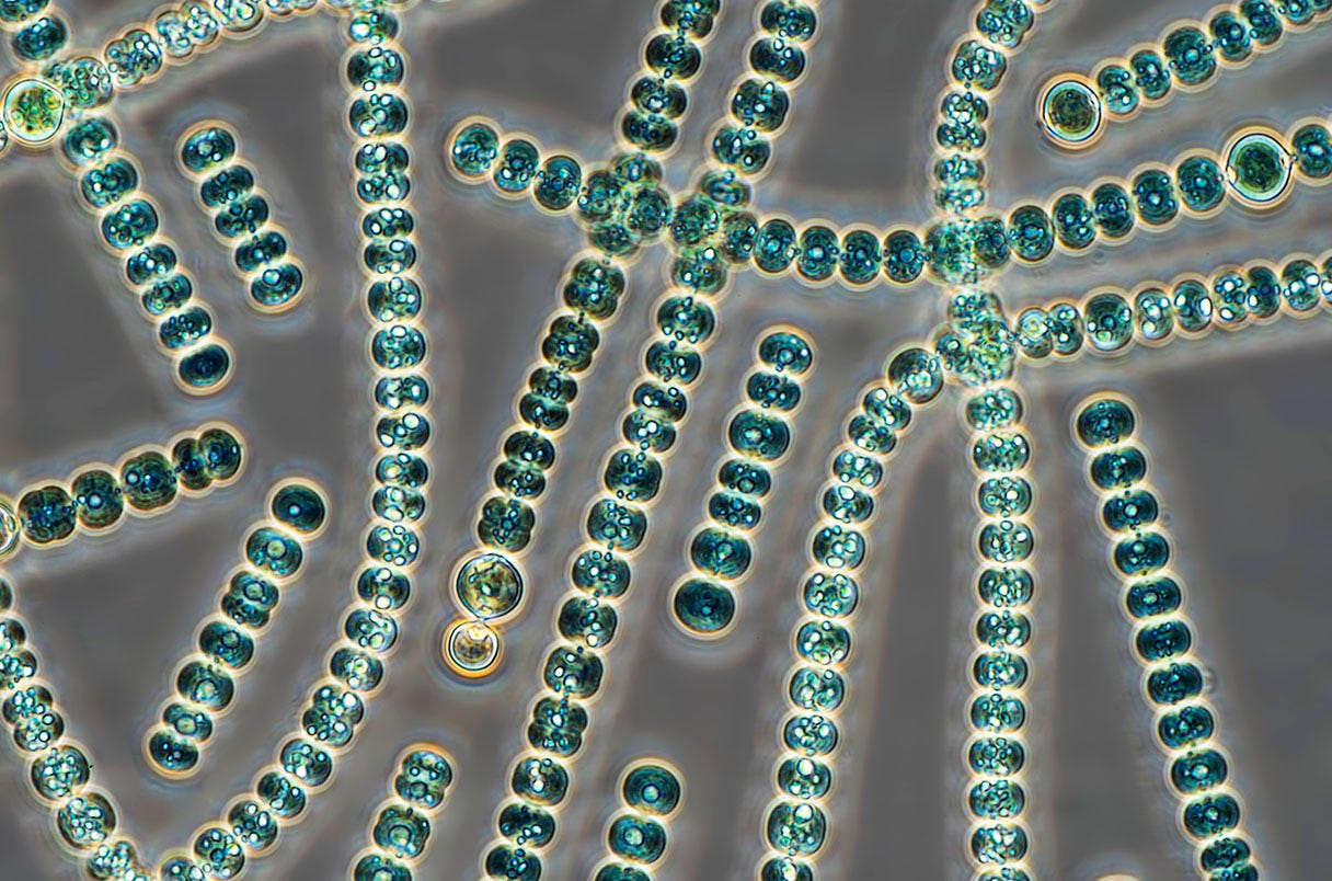 Phase contrast light micrograph of filamentous colonies of <em>Anabaena sp.</em> cyanobacteria.