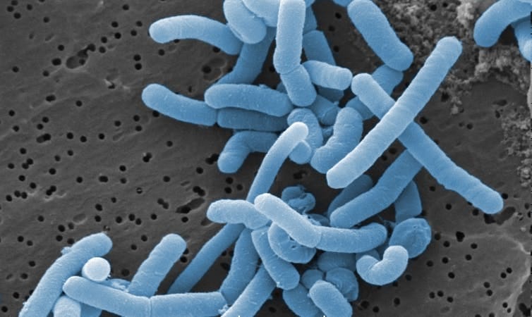 Microscope image of lactic acid bacteria