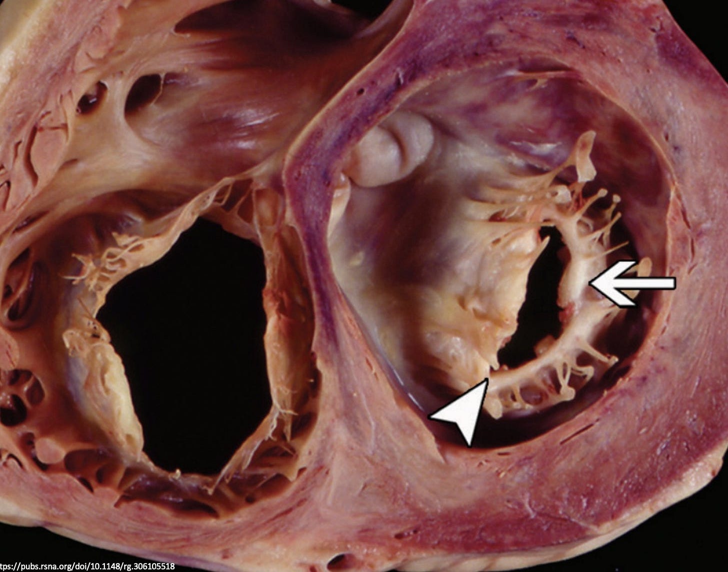 Episode 65 – Taking Things to Heart – The Curious Clinicians