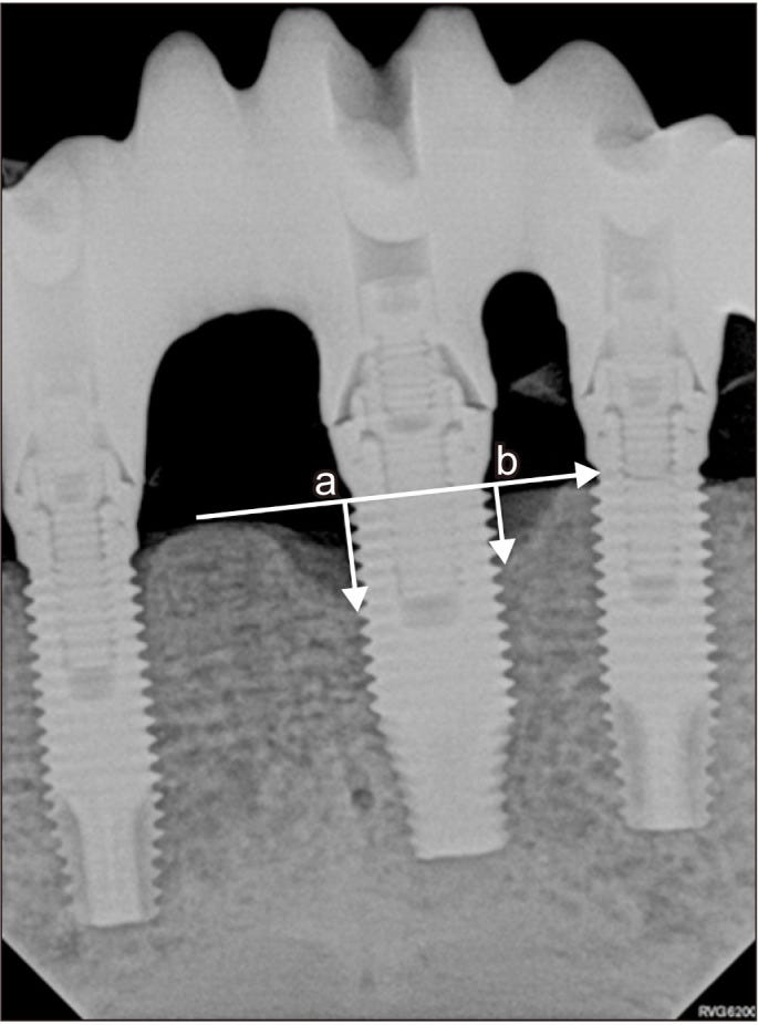 An external file that holds a picture, illustration, etc.
Object name is jkaoms-49-5-278-f1.jpg An external file that holds a picture, illustration, etc.
Object name is jkaoms-49-5-278-f1.jpg