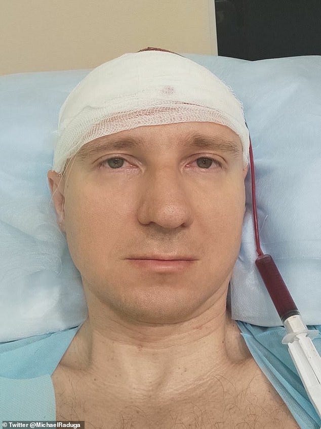 Raduga, 40, implanted an electrode into his brain to 'control his dreams'