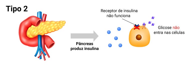 Vida saudável com diabetes | VEJA