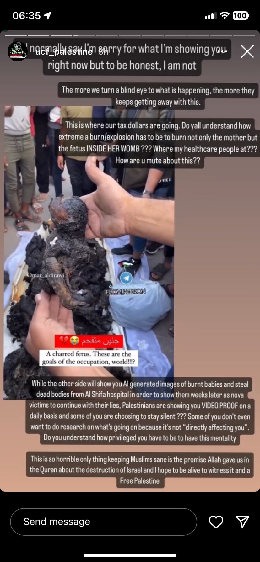 PSA Instagram story denying Jewish babies died
