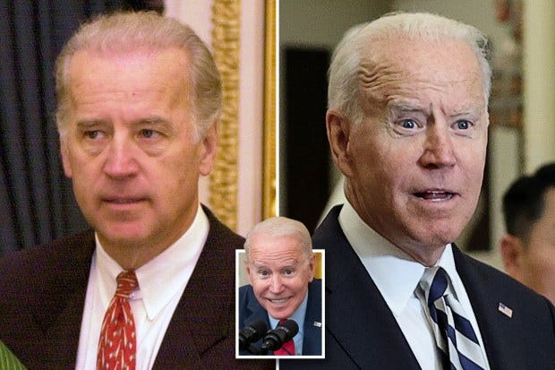 Secrets of Joe Biden's changing face revealed as plastic surgeons think  he's had multiple cosmetic procedures | The US Sun