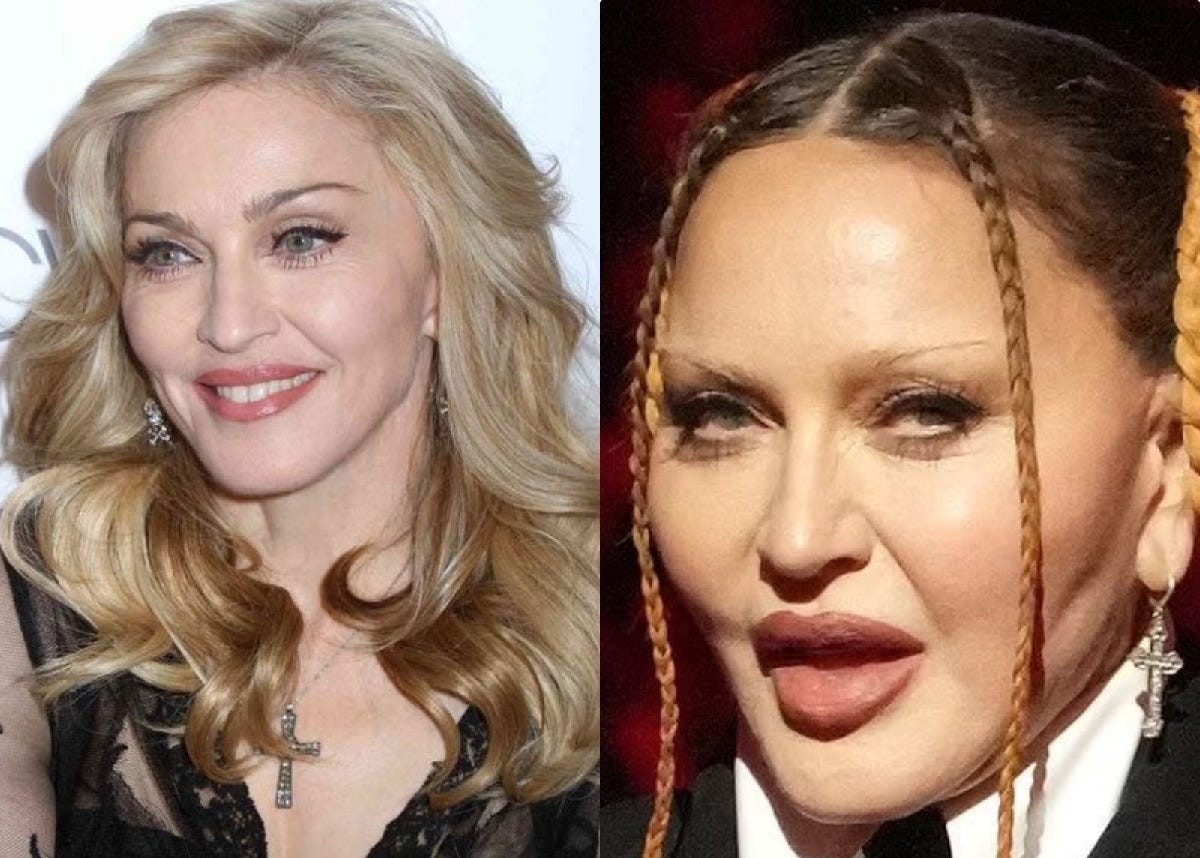 'Looks like it hurts': Madonna's 'new face' shocks fans [photos]