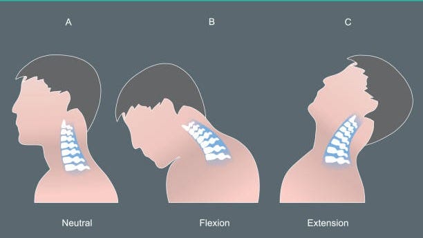 2,900+ Neck Extension Stock Photos, Pictures & Royalty-Free Images - iStock