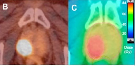 Image from: Multimodal imaging for radiation therapy planning in patients with primary prostate cancer, DOI:https://doi.org/10.1016/j.phro.2018.10.001 demonstrating an SIB approach.