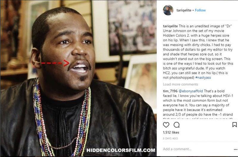 tariq nasheed instagram accusing umar johnson of herpes sore 2017