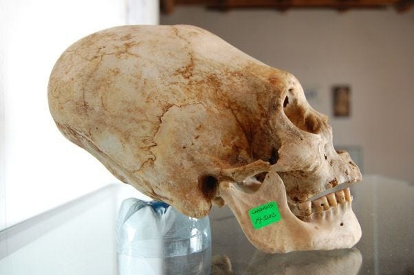 18 Elongated Skulls Of Paracas Peru [VIDEO] Raising Miro On, 58% OFF