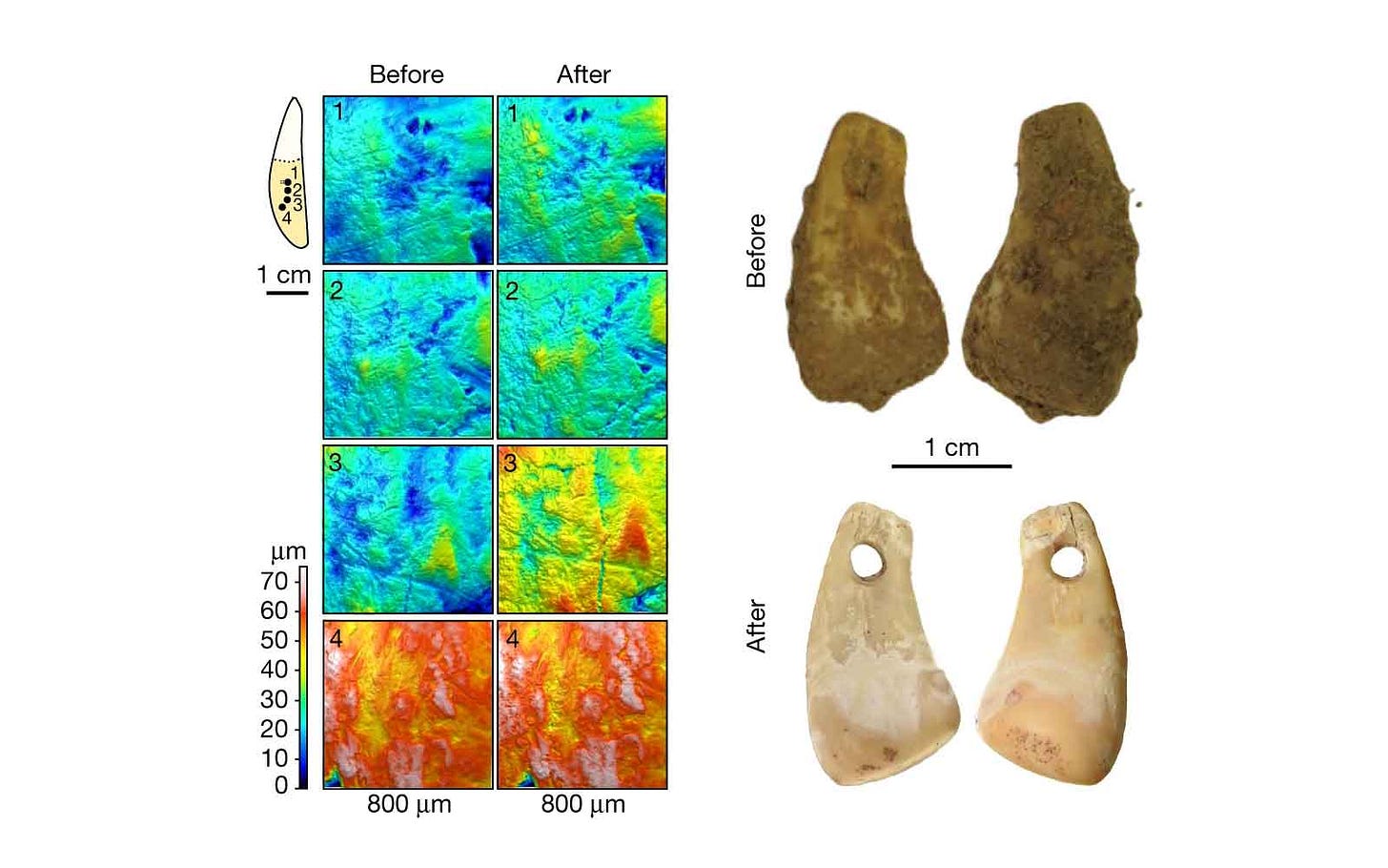 Micrographs showing texture of tooth surface at a microscopic scale, with images of the whole pendant before and after treatment Micrographs showing texture of tooth surface at a microscopic scale, with images of the whole pendant before and after treatment