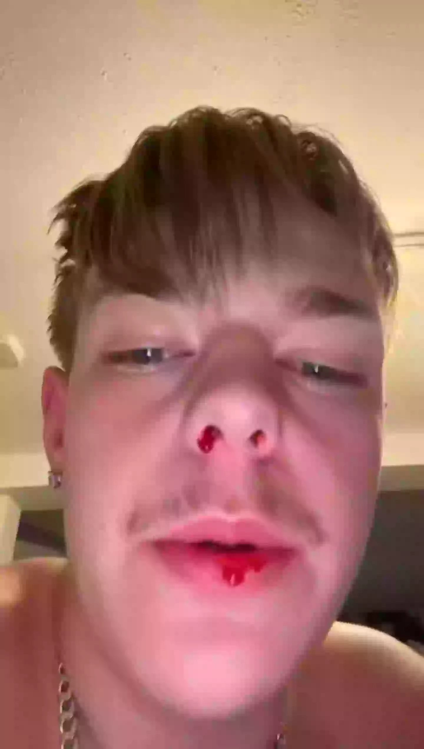 He was coughing up 'pints' of blood while on holiday. (Kennedy News and Media)
